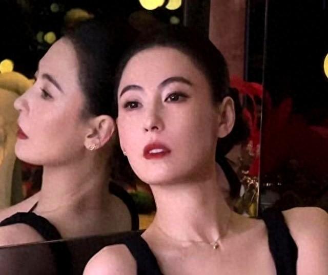 凸嘴正颌大概要多少钱（45岁张柏芝还在整牙新牙太大近照嘴都凸了）