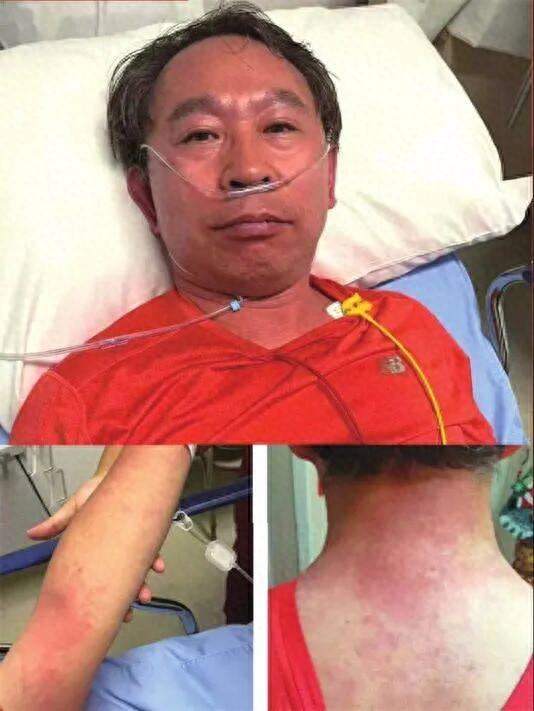 梦到没有头的人（以前不过敏）