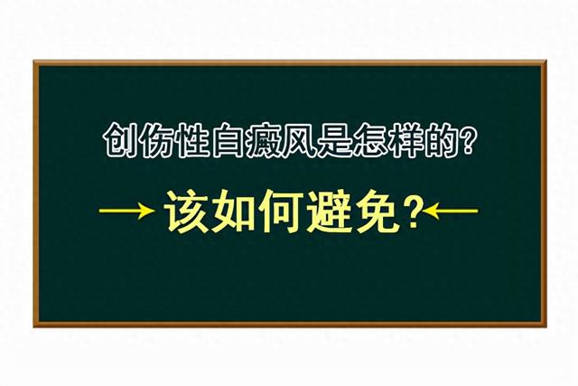 外伤型白癜风怎么才能治好（创伤性白癜风是怎样的该如何避免）