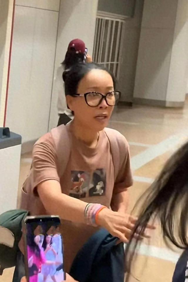 机场偶遇那英，脑门儿是填充了还是植发了？又肿又鼓不自然