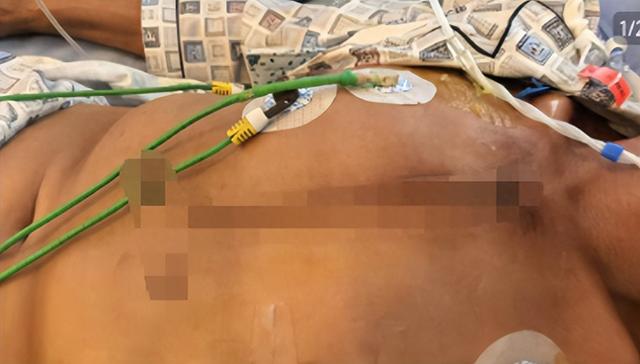 四川泸州一男子坐窗边玩耍时遭枪击身受重伤	，妻子：做了开胸手术，官方：已抓获4人