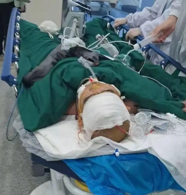 湖北十堰三名工人聚餐中毒，目前已有一人死亡，家属称食堂误把工业酒精当散酒	，律师：外包方应承担侵权责任