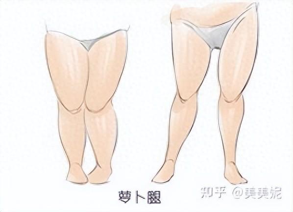 柯慧丽