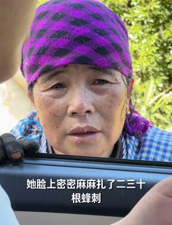 云南大姨被蜜蜂狂蜇，满脸蜂刺求助，过路司机惊呆，网友直呼惊险