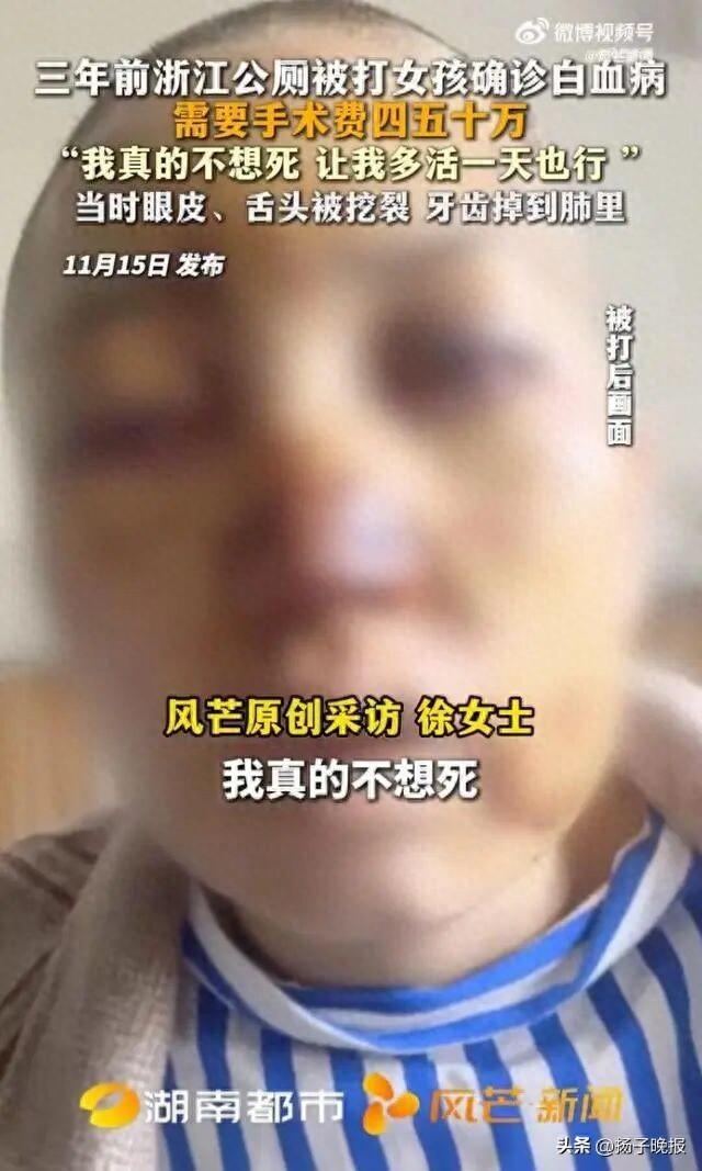 浙江公厕被陌生男子殴打20分钟的女孩确诊白血病：我真的不想死