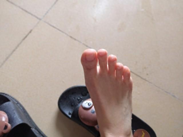 为什么撞到小脚趾的疼，能让人瞬间“灵魂出窍”？