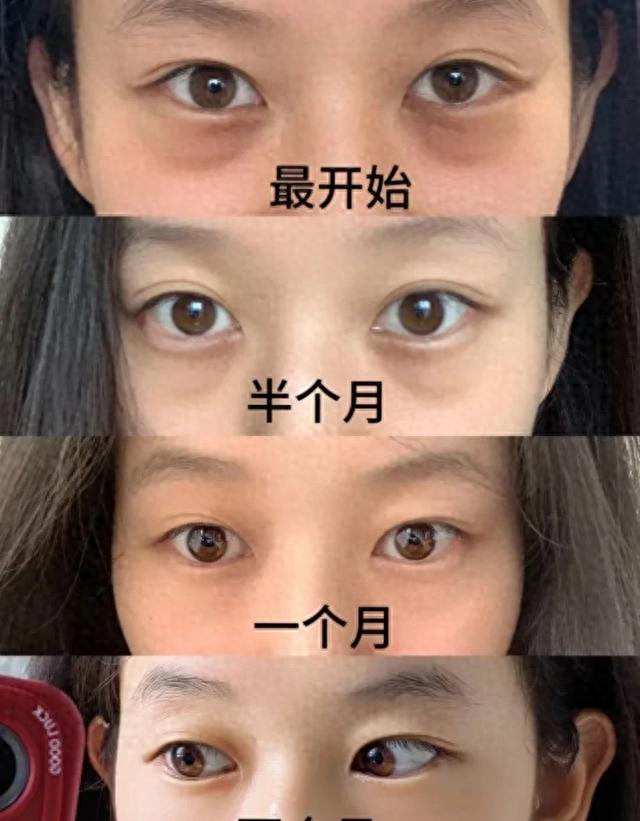 八段锦 + 面部瑜伽练 3 个月 13 天 新手也能逆袭！肤色匀了情绪