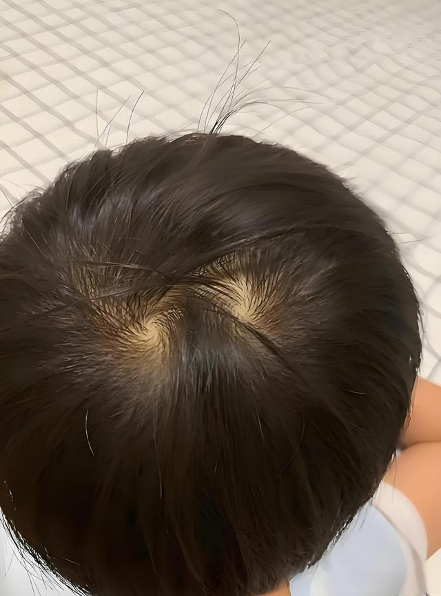 孩子头顶“2个旋”，到底代表什么？父母别不在意，看完涨知识了