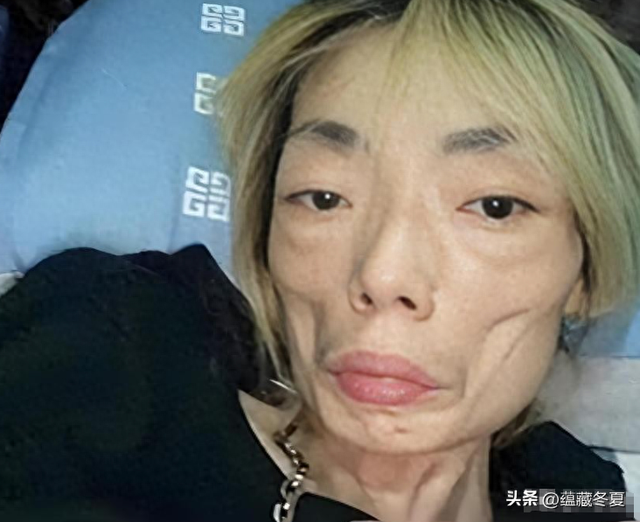 一代女神沦为豪门玩物？结婚8年牙齿全掉，器官切除，面似骷髅
