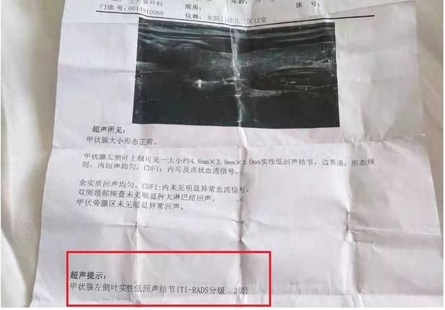 甲状腺结节一二三四级区别 2026年甲状腺结节一二三四级区别大吗