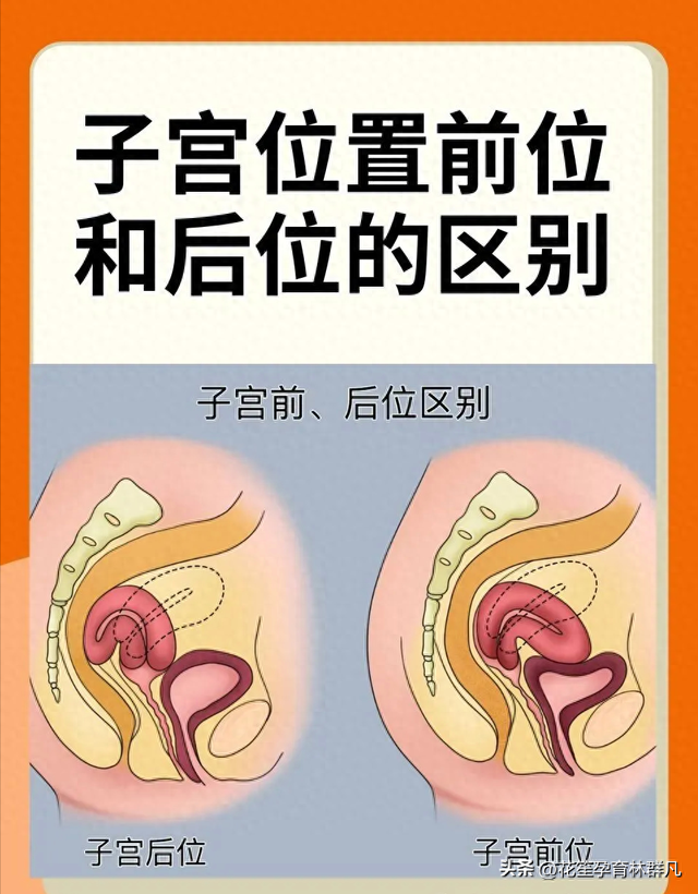 子宫前位,怎样有助于怀孕?（林群凡主任聊好孕女性子宫前位VS子宫后位）