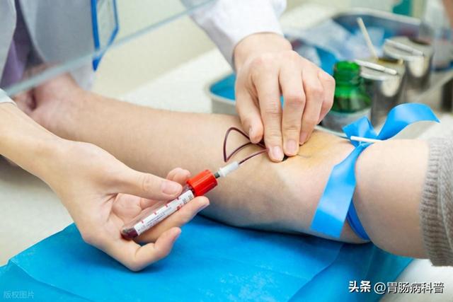 常规生化全套检查什么（生化全套检验及其临床意义）
