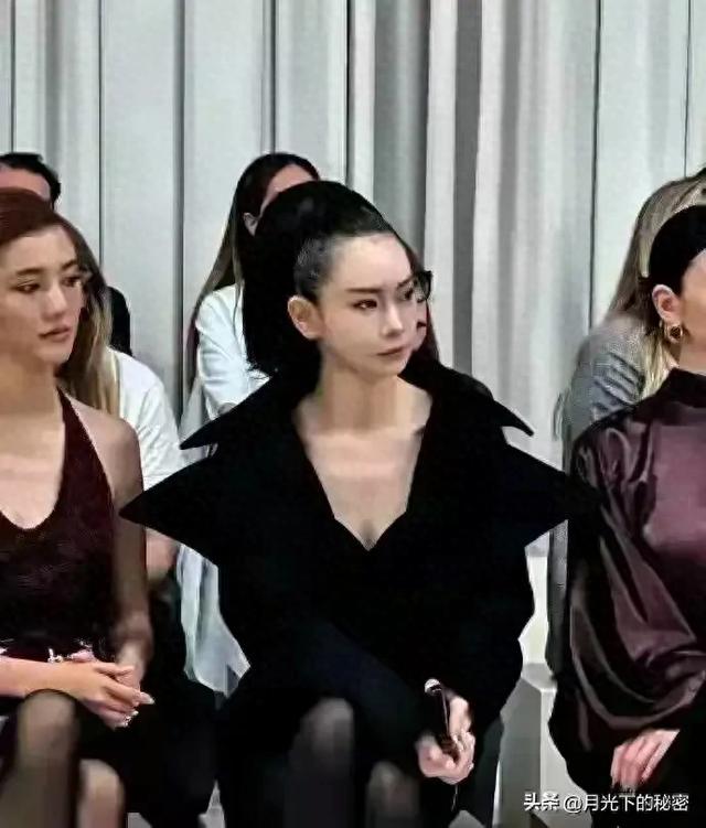 戚薇脸上做拉皮不疼吗? 但一却为了美 这样拉的发际线后移好难看