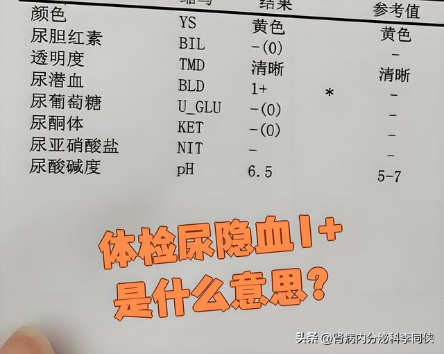 事业单位体检查出尿隐血1,通知复查了,（隐血1别焦虑医生讲清是否严重）