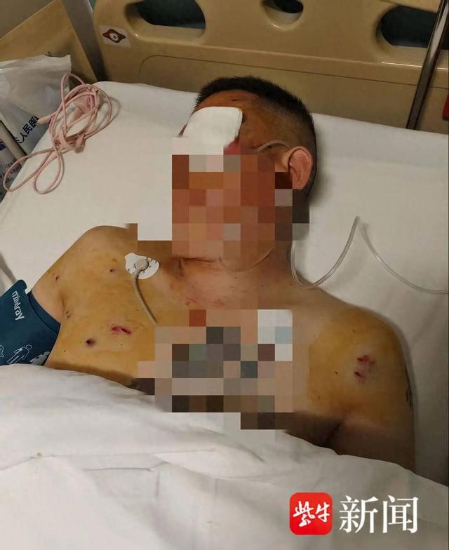 男子取170万元现金	，在银行门口遭抢劫致重伤左眼失明；当事人发声：银行工作人员和保安未制止或报警