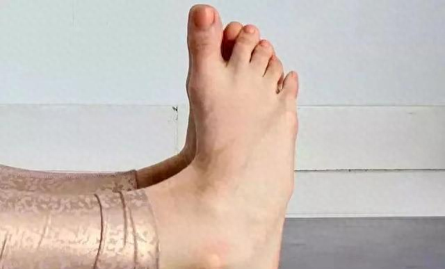 灵活双脚，强健根基	，一定要练习这10个动作！