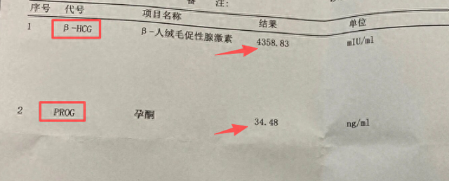葛忆曼
