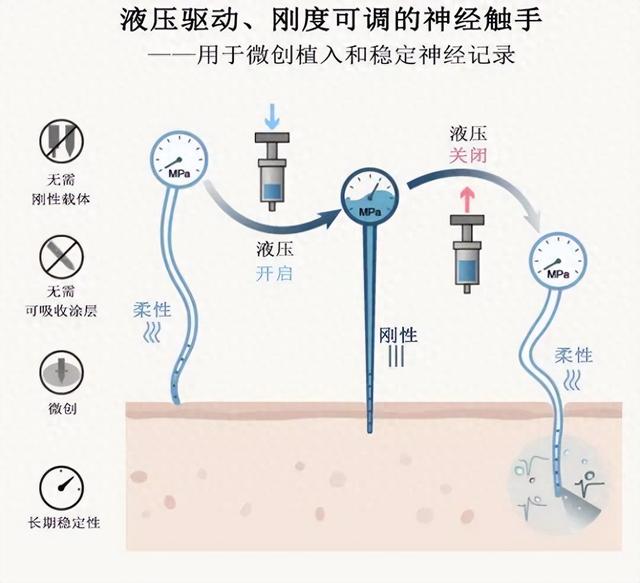 脑机接口重大突破！仿章鱼触手的“神经探针”实现微创植入