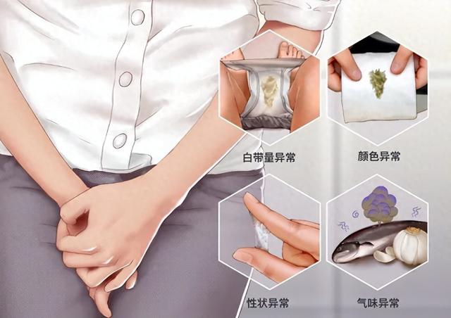 白带有颜色是正常吗（你的白带正常吗）