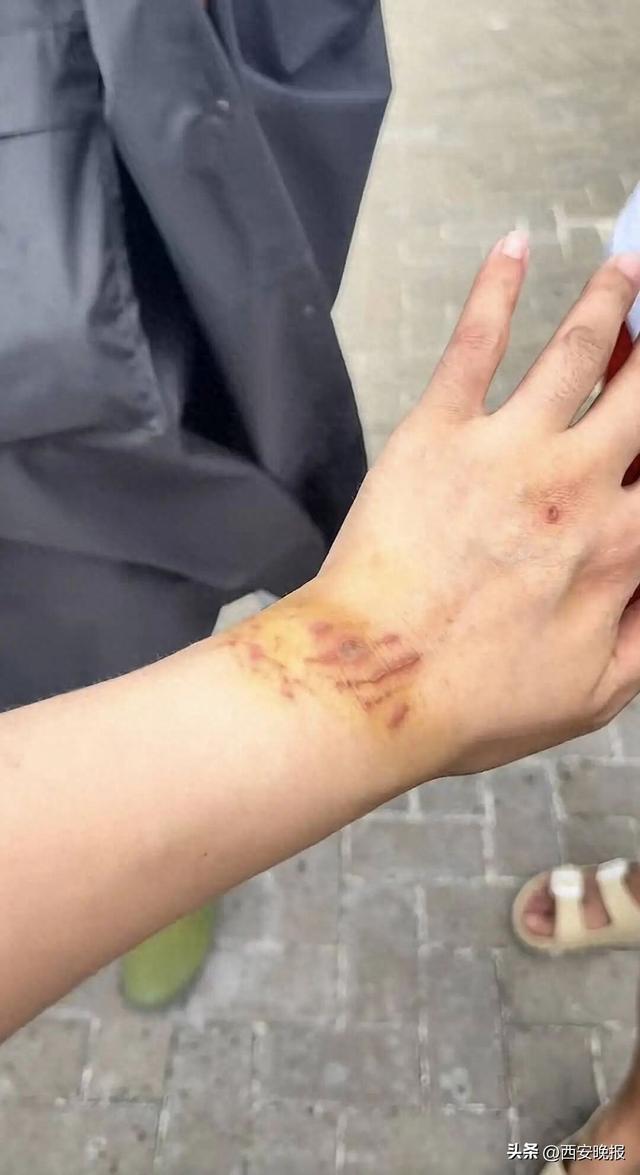 女子生理期潜水与鲨鱼群拍照时遭咬伤，被质疑“起号”炒作，当事人回应