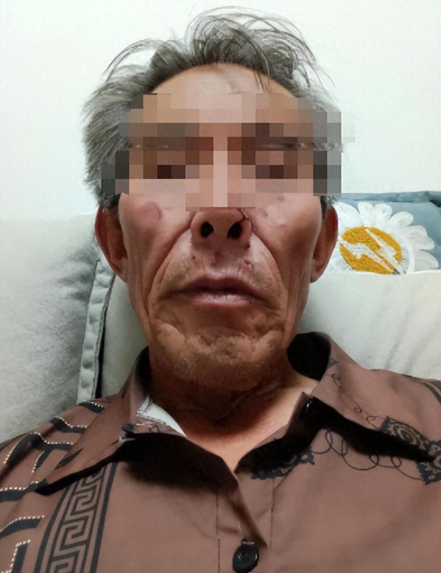 68岁保洁被游客群殴后续！伤情曝光是退伍老兵，警方介入网友炸锅