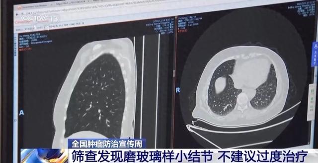 死亡突破僵尸战破解版（连续10年全球死亡率第一体检记得做这项检查→）