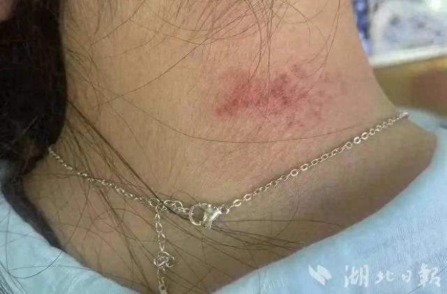 高毒性重金属超标！紧急提醒：不要长时间接触