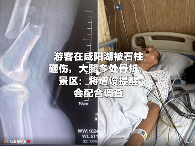 陕西一游客在咸阳湖被石柱砸伤，大腿多处骨折，景区：将增设提醒，会配合调查