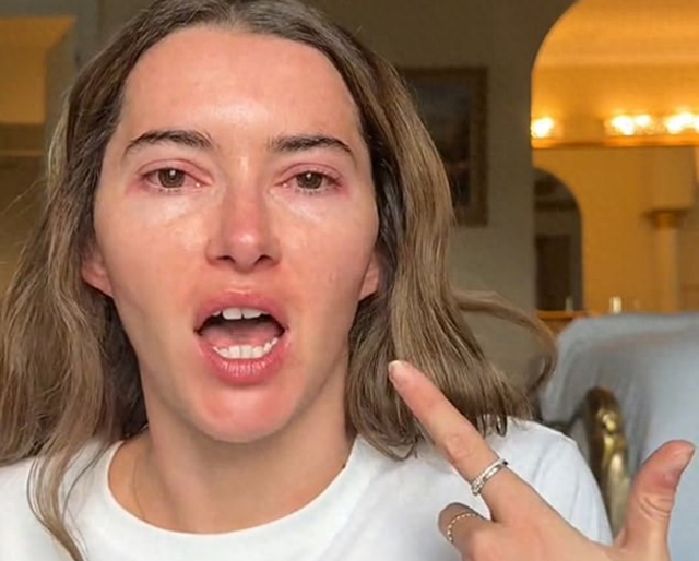 “恶心、自私	”	，美国网红在患高传染性疾病后，仍外出庆生遭抨击