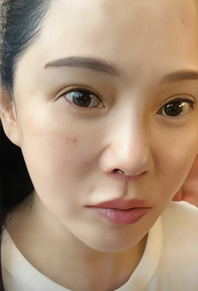 伊能静好真实，大胆展示自己脸上针孔，为了变美也是不容易啊