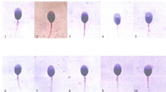 美女pk精子5攻略（精子界的黑神话悟空揭秘精子形态选美大赛）