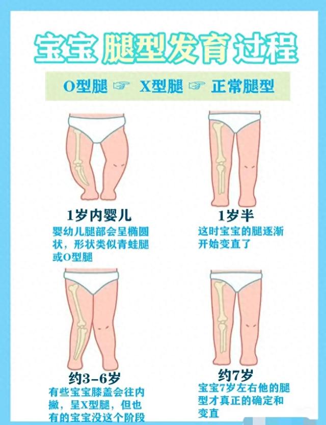 宝宝一周多想判断一下是不是O型腿图片附下图谢谢医生（宝宝O型腿是正常的宝宝腿部发育过程）