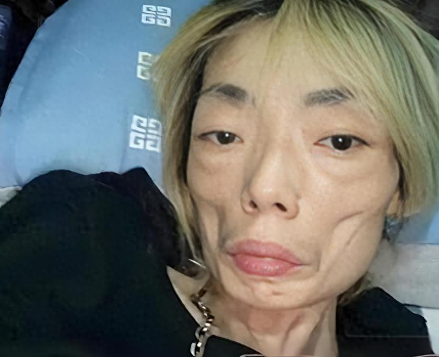 一代女神沦为豪门玩物？结婚8年牙齿全掉，器官切除，面似骷髅