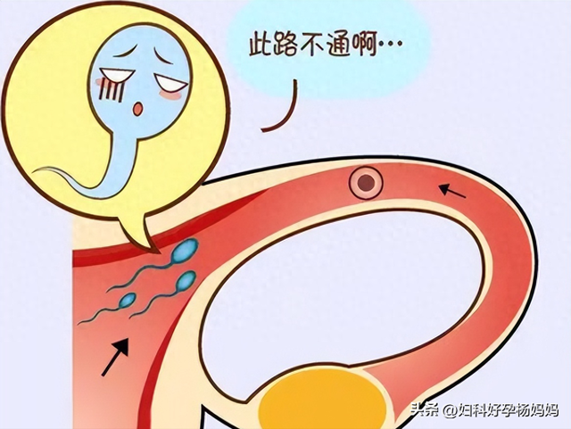 慢性输卵管卵巢炎怎么办（久备不孕）