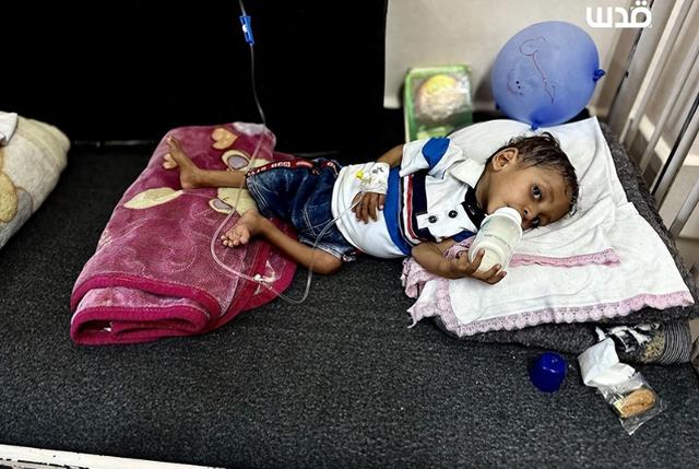 在纳赛尔医院的血泊与饥饿面前，这份报告显得荒诞无比