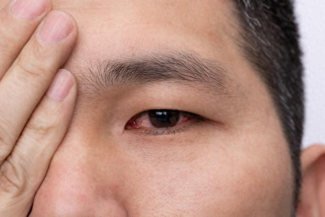 布林佐胺滴眼液的适应症是什么呢（10种眼病不用慌首选眼药全总结对症用药守护清晰视野）