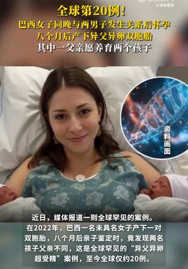 巴西女子同晚与两男子发生关系后怀孕，8个月后产下“异父异卵”双胞胎，其中一父亲愿养育两个孩子