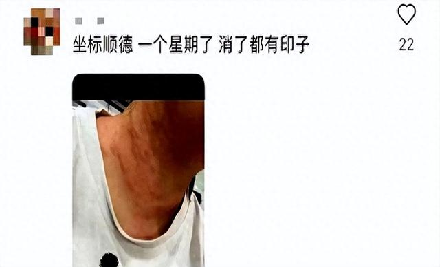世卫最新警报：可能爆发大规模疫情！辽宁疾控特别提醒→