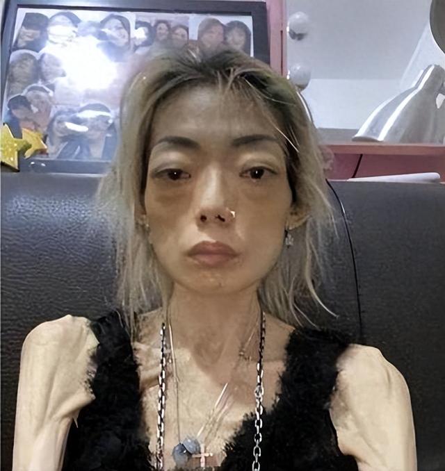 豪门玩物	，8年被折磨成牙齿全掉，不足80斤，形似骷髅	，惨不忍睹