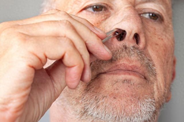 鼻毛总“窜	”出来的男人，暗示了啥？为什么鼻毛会变白？涨知识了