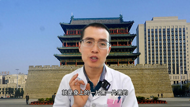 怎么治疗呢花斑癣会自愈吗（苏振兴花斑癣多洗洗澡）