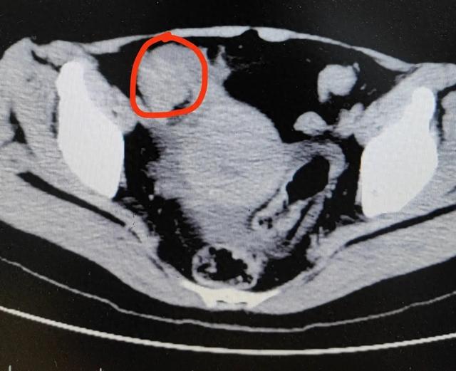 忍3破解版在哪下载（连吃3只）