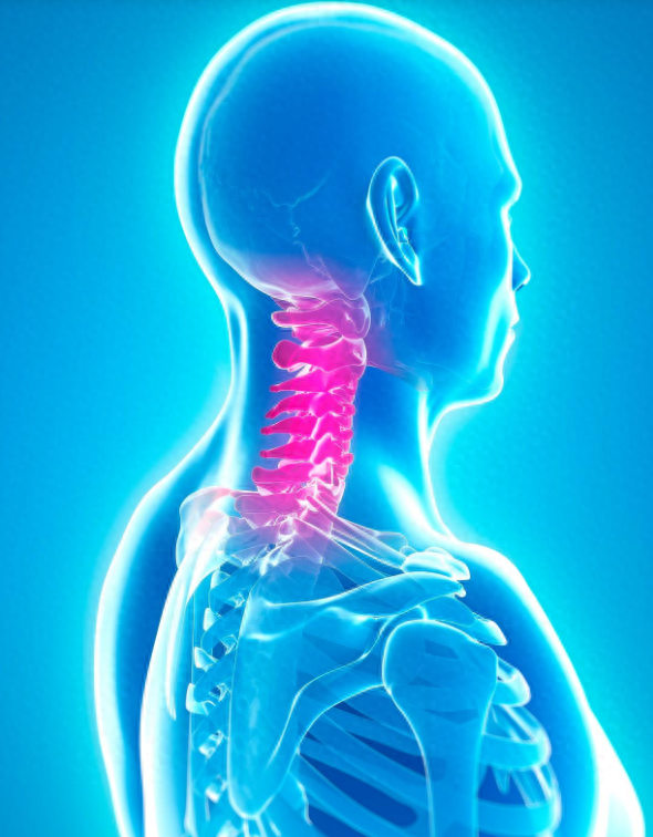 颈椎病睡觉的正确睡姿（颈椎病患者咋睡觉选对睡姿）