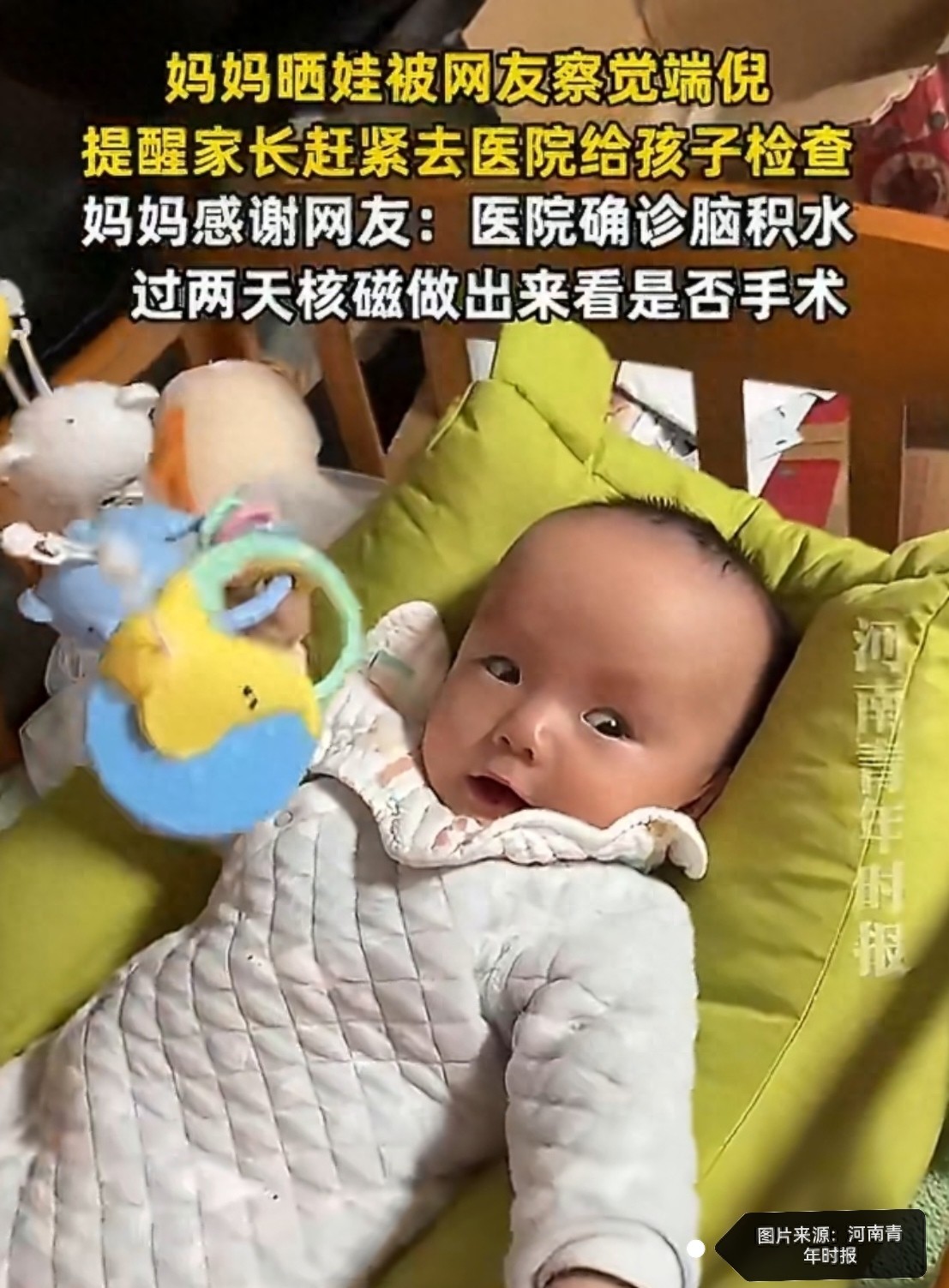 宝妈晒娃被催就医 孩子确诊脑积水 网友“火眼金睛”助早发现