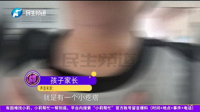 甲状腺瘤的临床症状有几种（4岁男童确诊甲状腺癌出现这个症状）