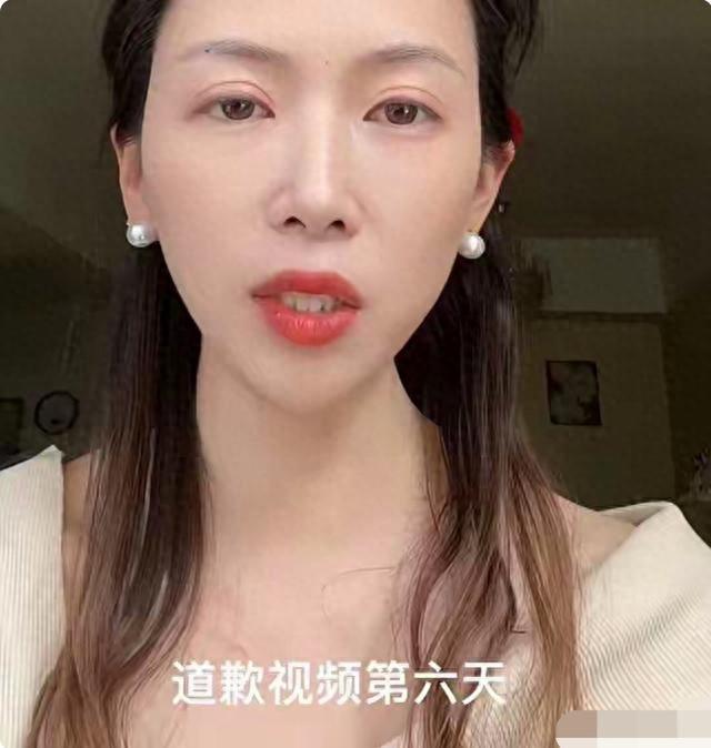 北京协和医院张海敏博士表示高敏感非缺陷	，