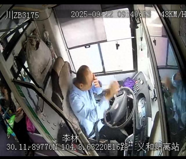 玻璃袭眼公交司机冷静停车护住16人 成都医生抢救英雄公交司机：左眼保住了，右眼分步康复