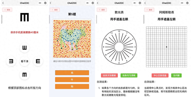 AI眼科医生在玉树｜国家巡回医疗队携ChatZOC眼科大模型助力青海玉树乡镇眼病筛查