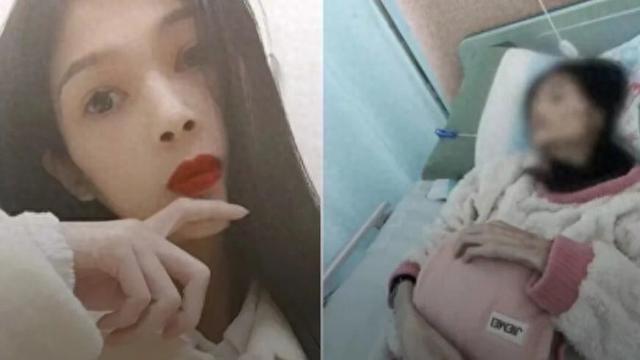 27岁女孩“巧巧”已离世，体重仅35斤，命运坎坷！早年父亲离世，母亲改嫁