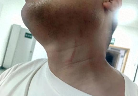 男子拍摄违停遭抢夺手机殴打，警方称因不构成轻微伤，罚款打人者500元，被打者称将起诉